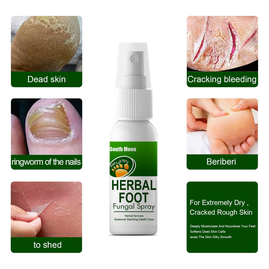 30ml bottle of foot skin nourishing and hydrating care spray with spray nozzle.