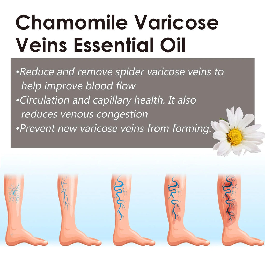 10ml bottle of pure chamomile essential oil for leg massage and skincare