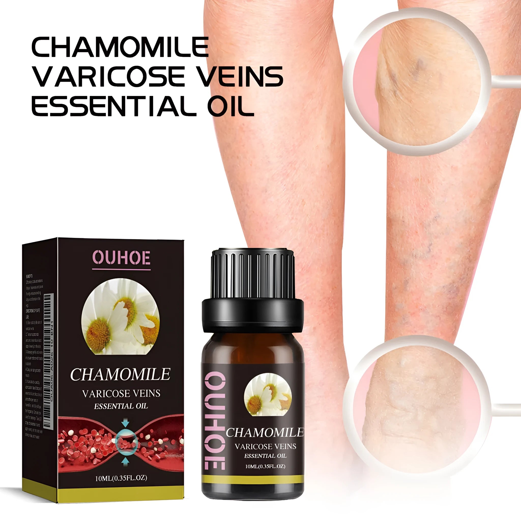 10ml bottle of pure chamomile essential oil for leg massage and skincare