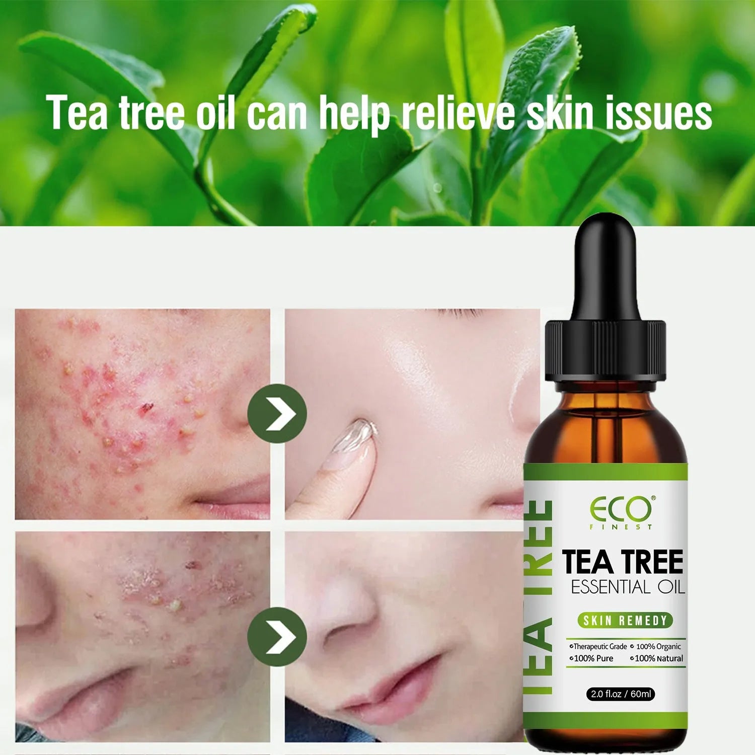 A 60ml glass bottle of pure tea tree essential oil for massage and skincare.