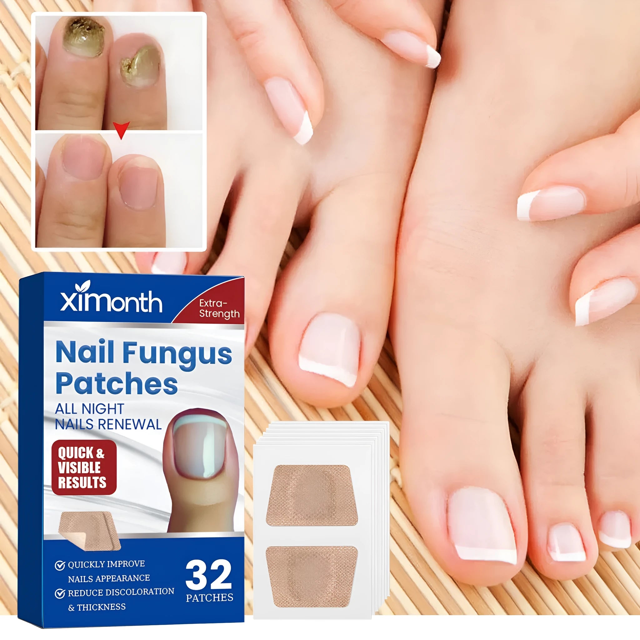 Box of 32 nail care adhesive bandage repair patches for damaged nails.