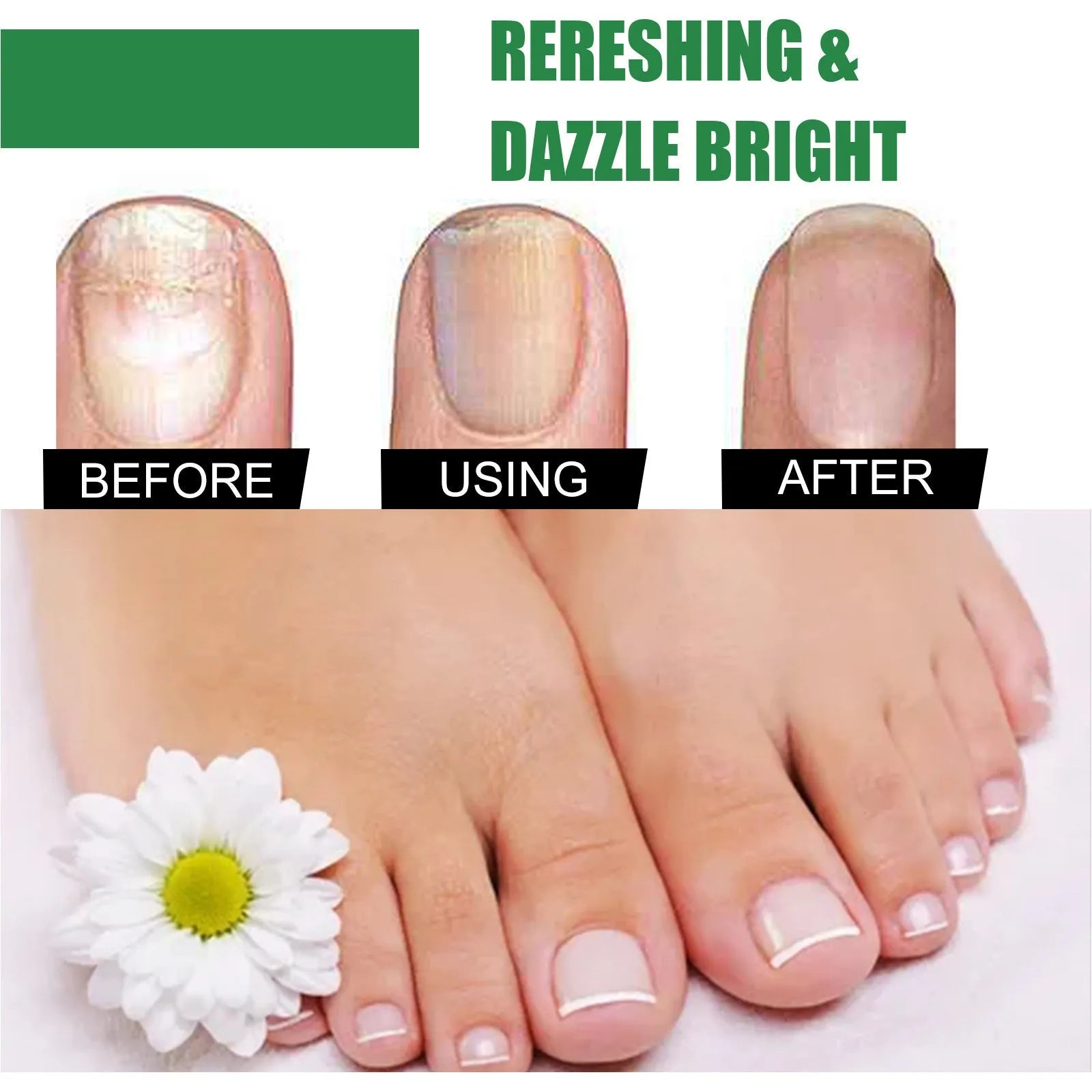 30ml tea tree oil nail care solution bottle with applicator for hand and foot nails