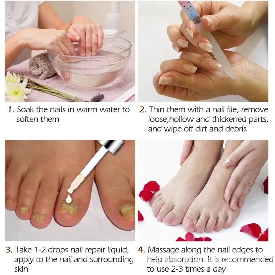 10ml bottle of whitening nail antibacterial liquid for fungal treatment and nail care