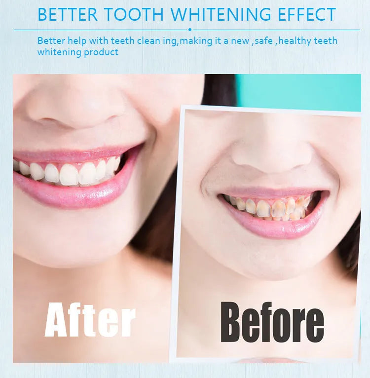 Teeth whitening pen with gel formula in plastic transparent or aluminium gold case designs
