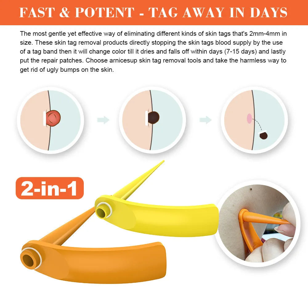 Orange mole removal tool kit with two devices, cones, rubber rings, alcohol swabs and repair sticker