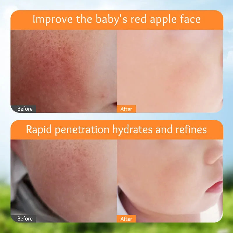 English Marigold Children's Moisturizing Facial Cream 50g standard specification for universal skin types