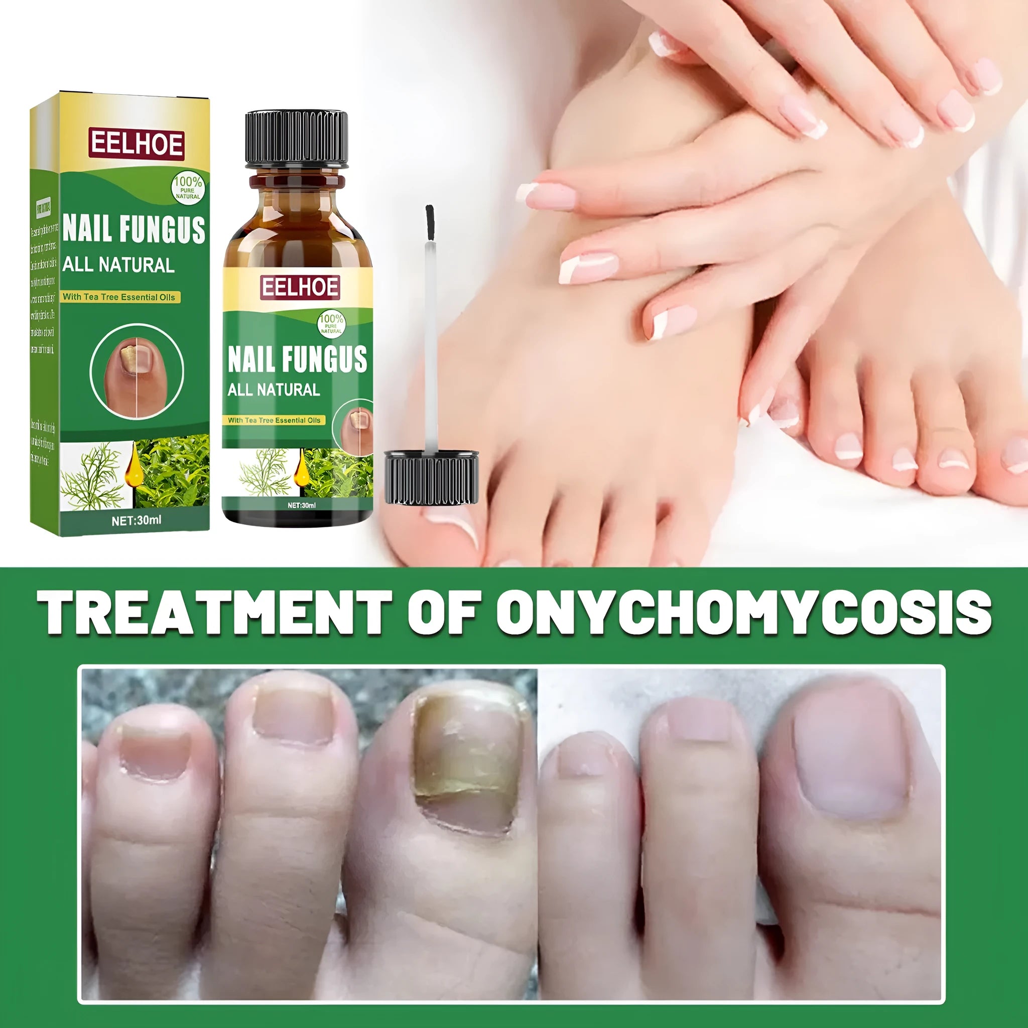 30ml tea tree oil nail care solution bottle with applicator for hand and foot nails