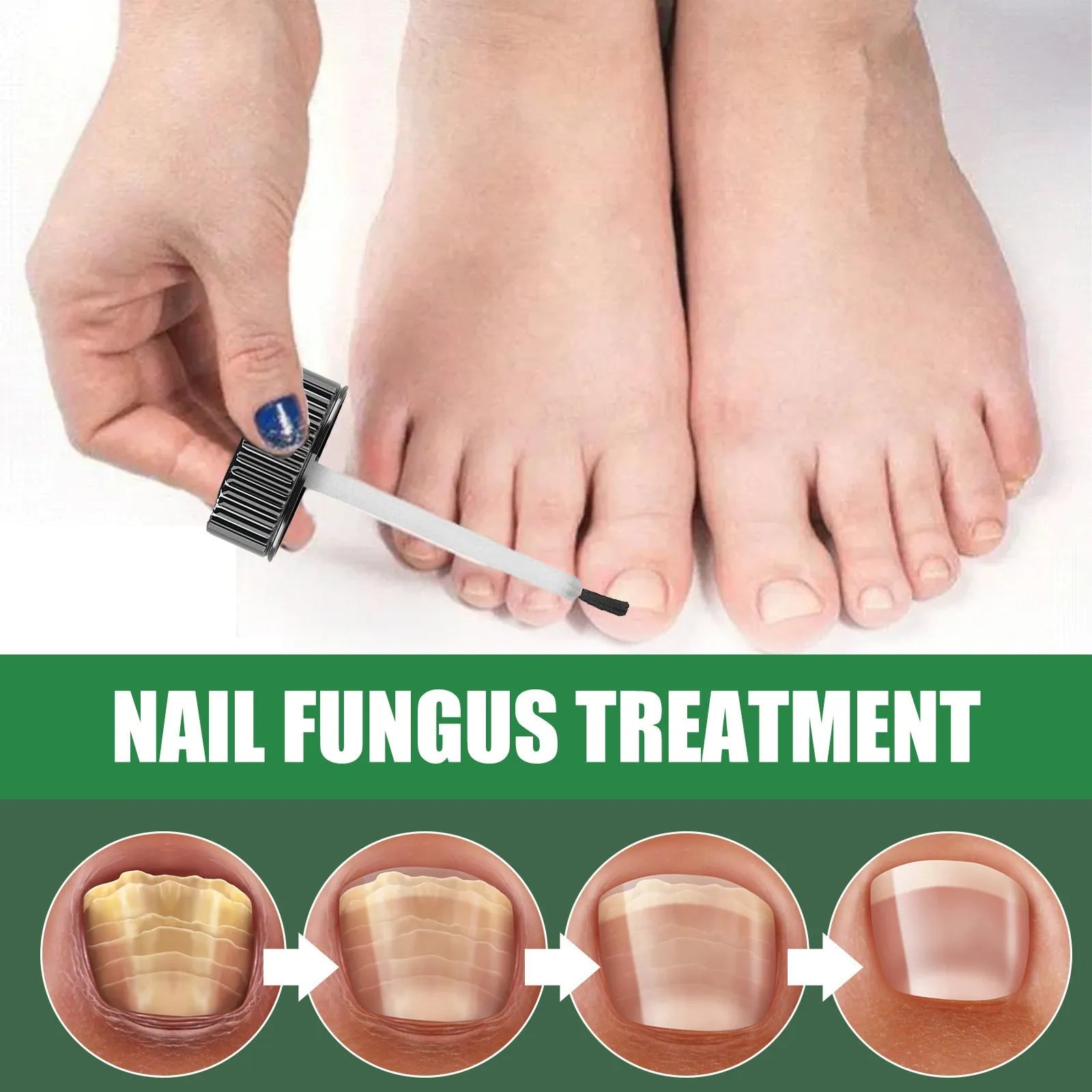30ml tea tree oil nail care solution bottle with applicator for hand and foot nails