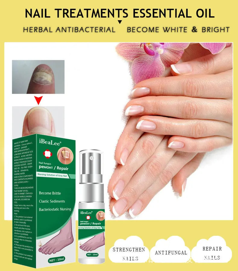 10ml bottle of whitening nail antibacterial liquid for fungal treatment and nail care
