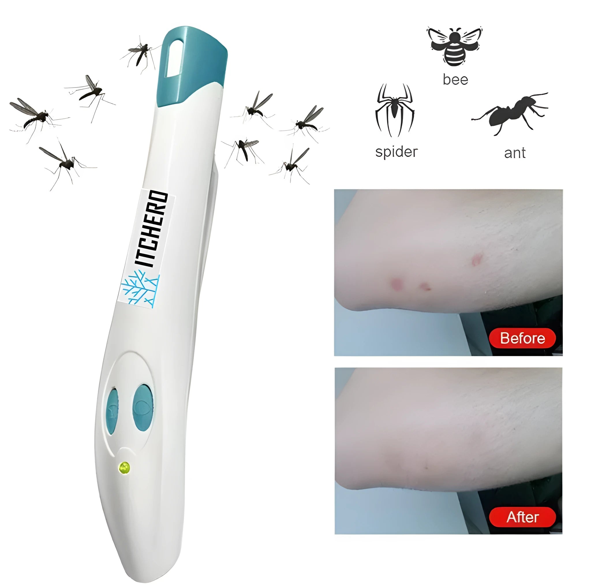 White and blue plastic antipruritic pen for mosquito bite relief in compact portable design